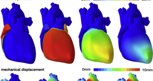 Una simulazione del funzionamento del muscolo cardiaco (Fonte: http://www.sciencedirect.com/)
