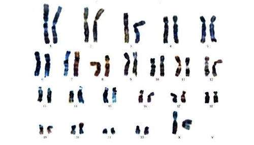 Le malattie genetiche vengono studiate attraverso l'uso di organismi avatar