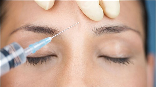 Iniezione di botulino applicata a scopi estetici